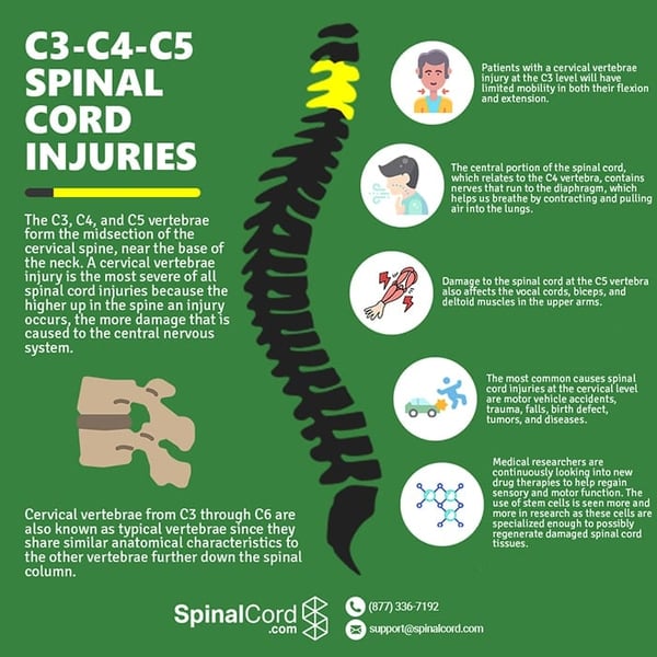 C3, C4, & C5 Vertebrae Spinal Cord Injury