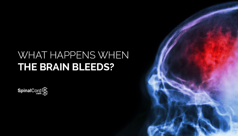 What Happens When The Brain Bleeds